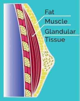Gynecomastia Diagram Gynecomastia Medical Diagram