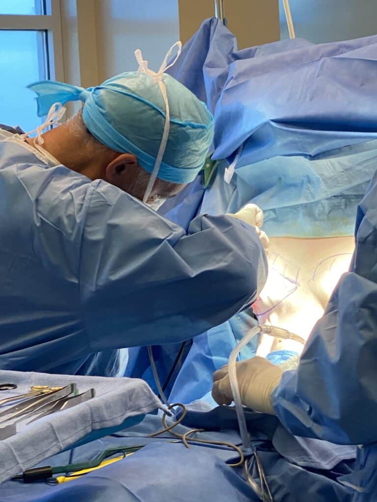 Dr. Miguel Delgado Discusses Passion For Gynecomastia. Dr Delgado Performing Gynecomastia Surgery